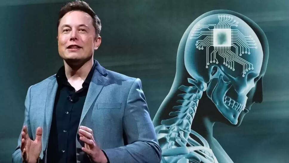 brain chip